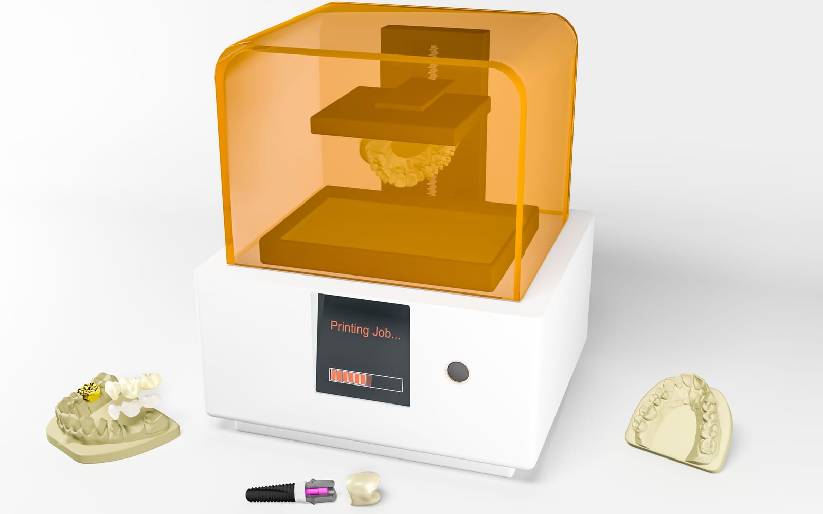 3D-Printing and Periodontology