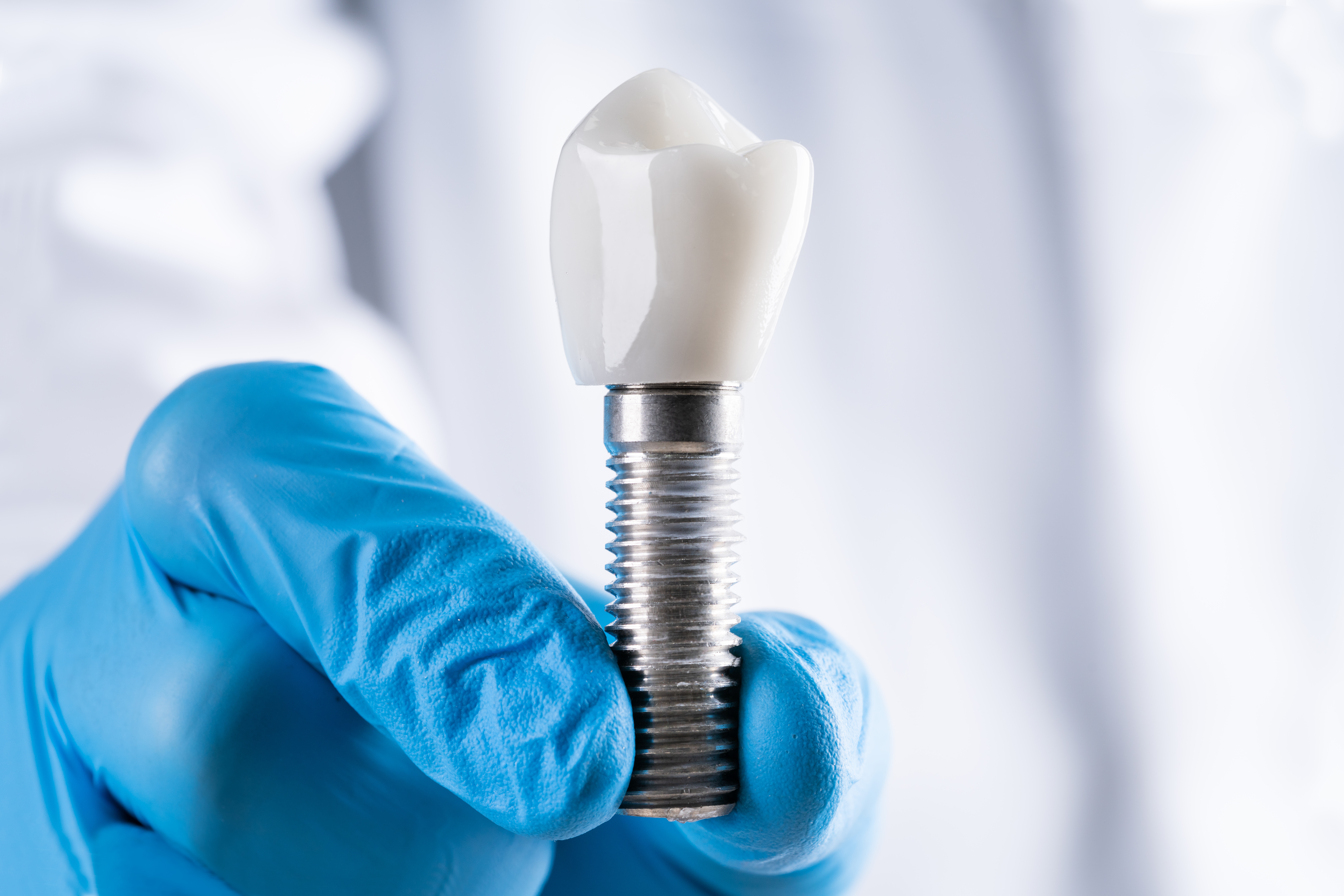 3 Reasons Dental Implants Are The Better Choice